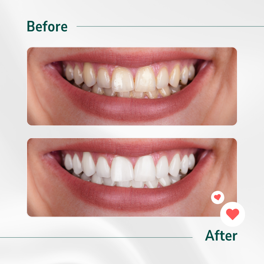 04282844-14f3-4f48-abaa-4ba980f70da3_1754559338_kem-danh-rang-perioe-total7-intense-pefresh-cooling-toothpaste-revodoi3.png