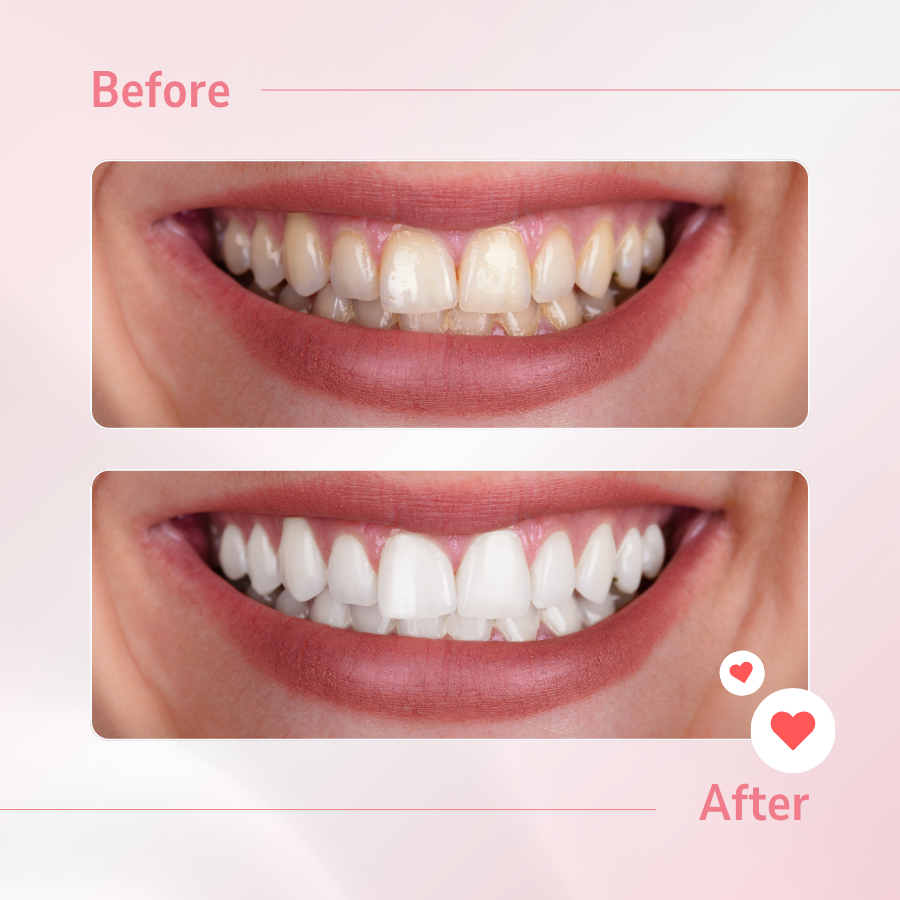 316c0a8e-1203-4324-bb76-84eddb5b7fb4_1754545846_kem-danh-rang-perioe-total7-intense-cleanmint-repair-toothpaste-revodoi1.png
